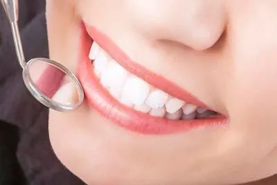 Teeth Whitening Dentit Las Vegas
