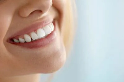 Teeth Whitening Las Vegas